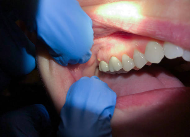 Best Emergency Denture Repair in Greenfield, WI